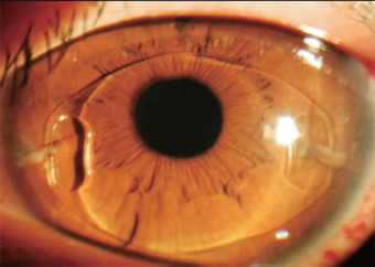 20170227055534663_ 拷貝 2